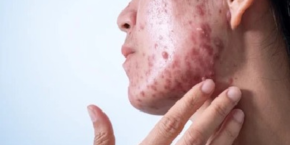 Ivermectin 6mg: Safe and Effective Treatment for Parasitic Infections