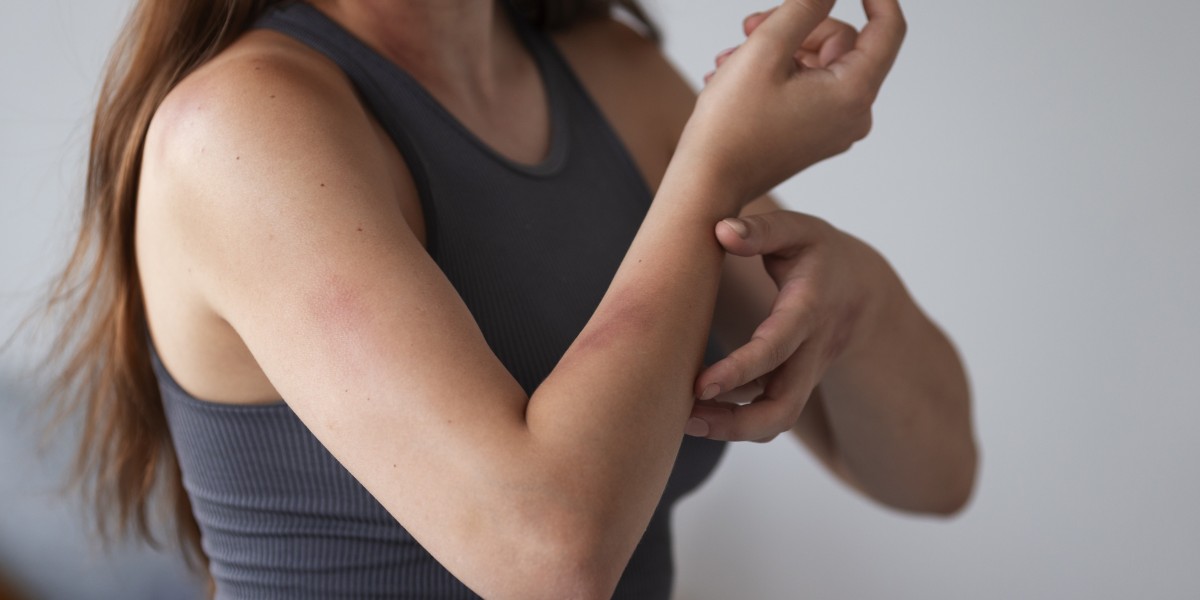 How Plastic Surgery Can Repair Your Burn Scars